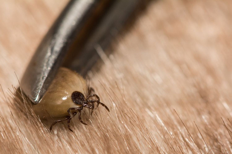 Alternative Earthcare Warns Untreatable Form Of Lyme Disease Could Hit